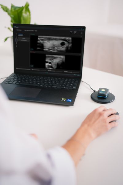 PIUR tUS Infinity 2